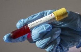 Coronavirus: 15 casos activos en la ciudad y nueve en estudio