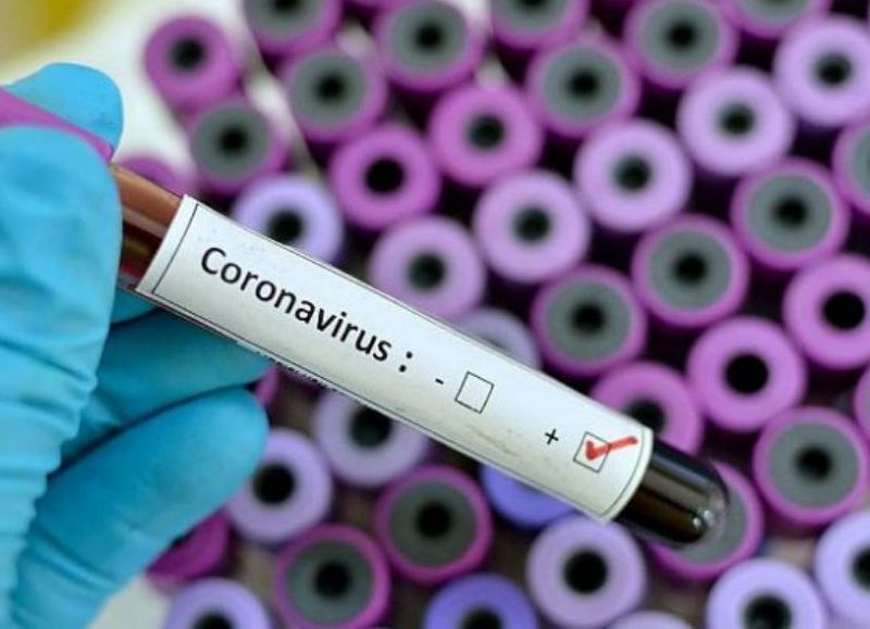 Una enfermera de 48 años se convirtió en el primer caso positivo de coronavirus en Chascomús.

